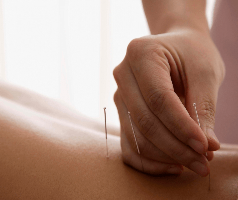 Acupuncture & Chronic Disease