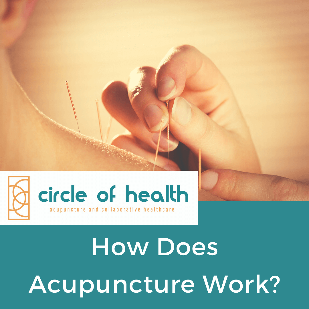 How Does Acupuncture Work? Circle of Health Longmont