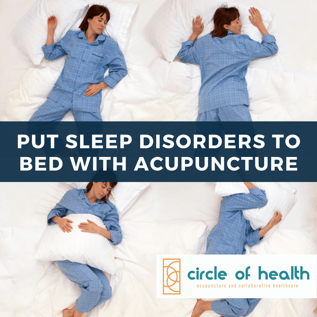 Put Sleep Disorders to Bed with Acupuncture